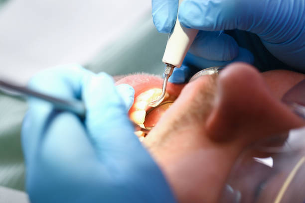 Best Emergency Treatment for Toothache in Beaver Falls, PA
